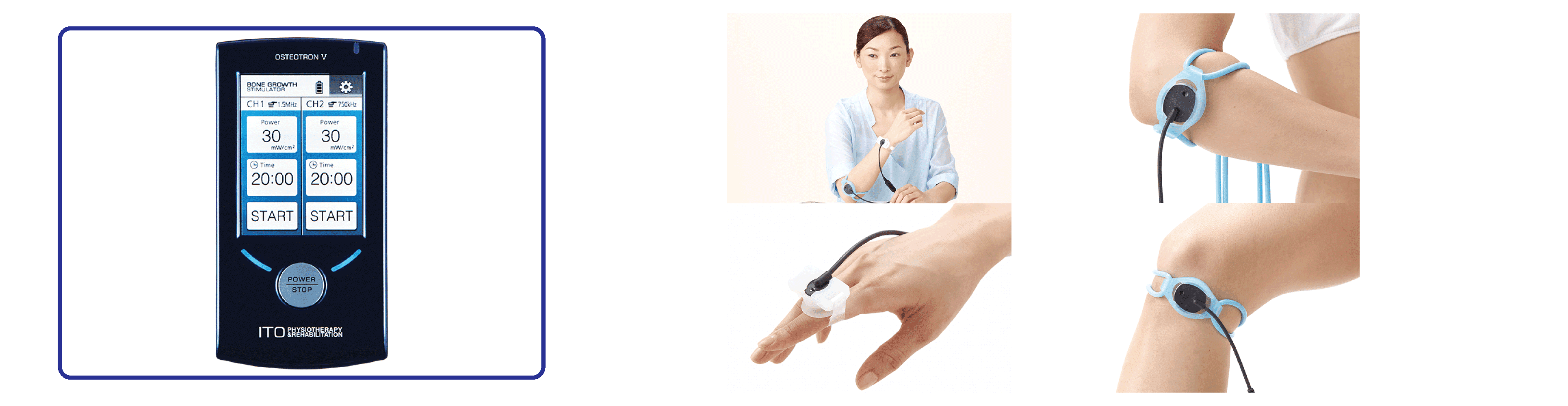 超音波骨折治療機オステオトロンVの説明